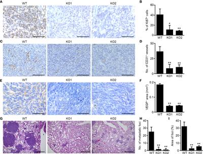 Osteosarcoma-Derived Small Extracellular Vesicles Enhance Tumor Metastasis and Suppress Osteoclastogenesis by miR-146a-5p